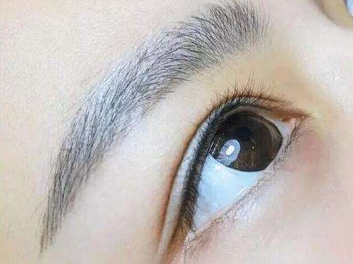 醫(yī)生技術(shù)驚艷！重醫(yī)賀光照眼部整形迎來新突破