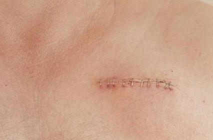 溫州附屬第一醫(yī)院鄭君達主治領(lǐng)域及醫(yī)療項目詳解