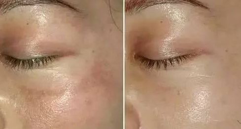 常州市第一人民醫(yī)院整形燒傷科：找對醫(yī)生，就對了！