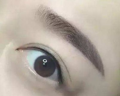 廈門哪家整形醫(yī)院口碑好？專家推薦薇格、中山前三！