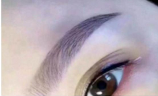 上海求美醫(yī)院最權(quán)威的拉皮整形專家名單及案例分享，查看收費(fèi)明細(xì)表