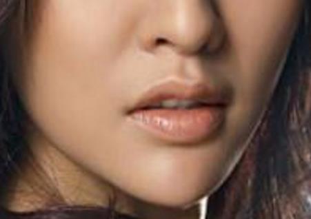 滄州中心醫(yī)院整形科馬超雙眼皮修復(fù)有哪些效果？是否可持久保持雙眼皮效果？