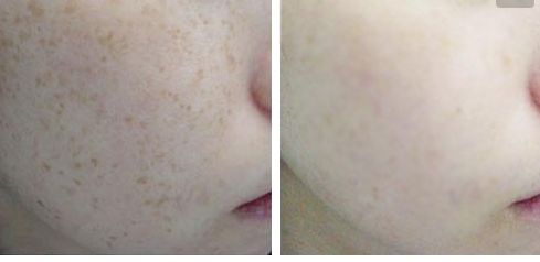 2023南寧臉部整形領(lǐng)域中醫(yī)生技術(shù)評析