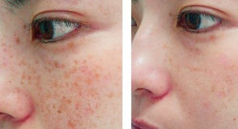 贛州亞韓醫(yī)療美容門診部整形手術適合嗎？吳禮誠醫(yī)生技術評價如何