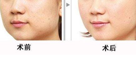 北京清華長庚醫(yī)院為何不列入三甲？整形技術(shù)如何？名醫(yī)推薦給你