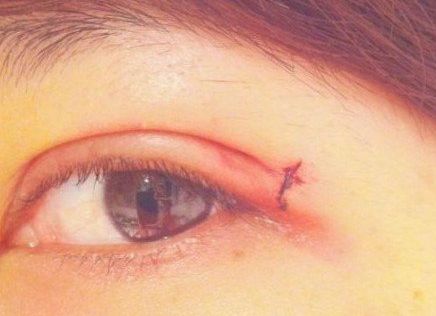 南寧受追捧的整形醫(yī)院，魅力明星推薦，獨特亮點閃耀