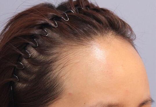 哈爾濱羽禪醫(yī)美，哪些熱門項(xiàng)目受歡迎？