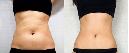 北京下頜角顴骨矯正，這幾家醫(yī)院排名前五不可信！