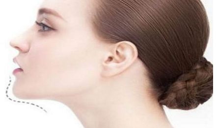 江門植發(fā)醫(yī)院專業(yè)推薦！華美植發(fā)、瑪恩植發(fā)被廣大客戶一致好評！