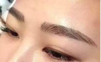 北京五家太陽穴整形醫(yī)院，排名榜揭曉！手術(shù)前必知攻略，高能提醒！