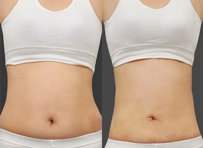 智慧選擇，打造肌膚零瑕疵！廣東祛斑醫(yī)院大比拼，真實(shí)實(shí)力PK！