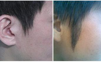 西安著名拉皮手術(shù)醫(yī)生推薦！專家團(tuán)隊不俗技藝，魯禮新、楊萬忠亮相