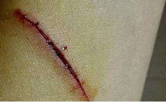 長沙治療內(nèi)眼角問題哪家醫(yī)院靠譜？這些醫(yī)療機構(gòu)備受推崇