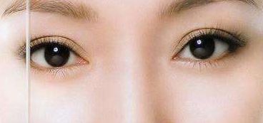 哪個(gè)整形科醫(yī)生在北京協(xié)和醫(yī)院備受推崇？醫(yī)術(shù)精湛、豐富經(jīng)驗(yàn)是參考。