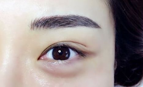 重慶杰出眼科專家范文亮醫(yī)生：醫(yī)術(shù)高超，多個成功案例揭秘