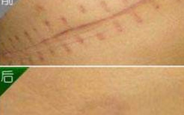 北京非常受歡迎的鼻部整形醫(yī)生，排名一覽！