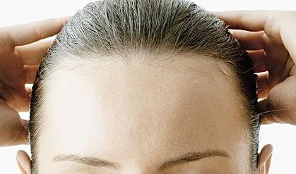 郭建玲雙眼皮修復(fù)費(fèi)用揭秘！看真實(shí)案例圖分享，了解其技術(shù)效果！