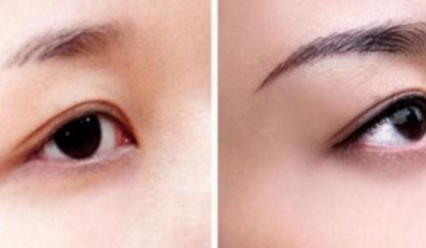 新一期海南隆鼻醫(yī)院名單來啦！維多利亞實(shí)力引領(lǐng)口碑榜！