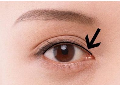 南京胸部整形醫(yī)生吳國平的最新成功案例！