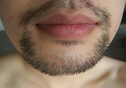 哪些醫(yī)院是滄州祛疤的好選擇？你知道嗎？