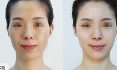 郴州市十佳整形醫(yī)院盤點(diǎn)，名醫(yī)推薦，千萬(wàn)不要錯(cuò)過(guò)！