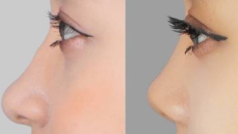 瀘州市更受歡迎的整形醫(yī)院匯總！留言好評(píng)口碑實(shí)力大揭秘！當(dāng)?shù)蒯t(yī)美熱門推薦！