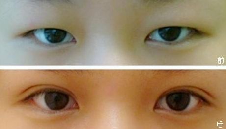 塑造完美鼻型，一觸即達(dá)！隆鼻醫(yī)生品牌推薦，成功案例揭秘，費(fèi)用一覽表震撼來襲