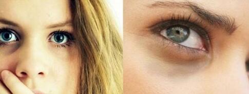 廈門碧蓮盛植發(fā)醫(yī)院效果如何？安全可靠嗎？