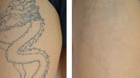 2023年鄭州整形醫(yī)院最新推薦！天后、華領(lǐng)、美萊等全面介紹！