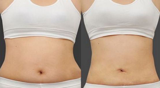 搶先掌握北京市雙眼皮醫(yī)生榜單名單，詳細了解醫(yī)生資料