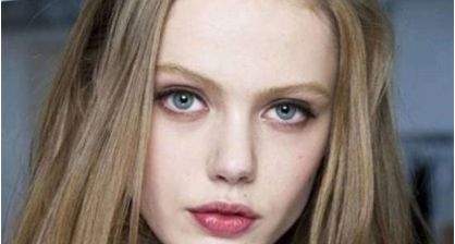 北京著名整形專家王光輝展示雙眼皮術(shù)的絕美案例，讓您了解如何變美的方法