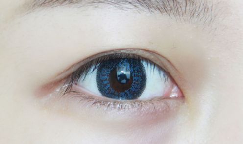 興義市哪家整形醫(yī)院做雙眼皮效果好？2023成功案例發(fā)布