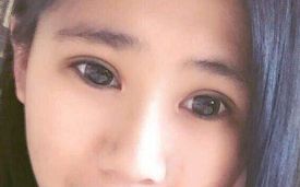 羅飛彪醫(yī)生開展的鼻子整形手術(shù)，售價(jià)一覽表，各種風(fēng)格任你挑選！