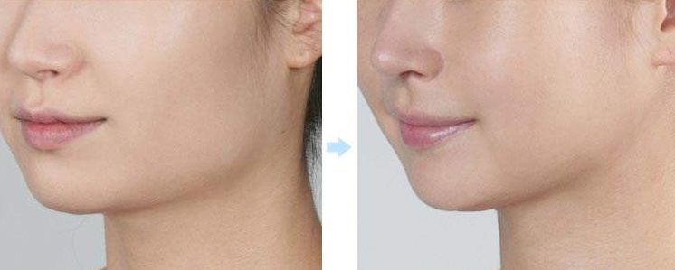 成都整形醫(yī)院揭曉：這五家醫(yī)院獲得排名前列！