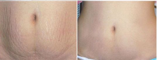 多位知名醫(yī)生修復(fù)雙眼皮技術(shù)對(duì)比，王太玲和盧建建誰(shuí)更出眾？立體醫(yī)學(xué)美容室推薦名醫(yī)修復(fù)雙眼皮解析及價(jià)格大