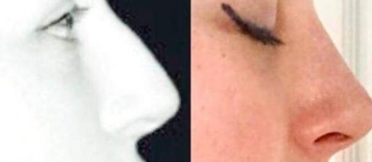 杭州整容醫(yī)生：陳小平、曾海峰長(zhǎng)期位居榜首