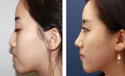 廈門整形醫(yī)院綜合評(píng)比，首屈一指的醫(yī)療機(jī)構(gòu)引領(lǐng)行業(yè)潮流