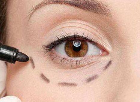 唐山優(yōu)秀雙眼皮修復(fù)醫(yī)生口碑盤點(diǎn)，案例分析、價(jià)格透明