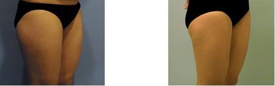 沈陽雙眼皮整形醫(yī)生哪位技術(shù)出眾？受歡迎的三位醫(yī)師推薦2023