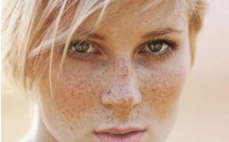 青州人民醫(yī)院美容科，了解一下主任介紹丨2023價(jià)格表丨激光祛痘案例排行