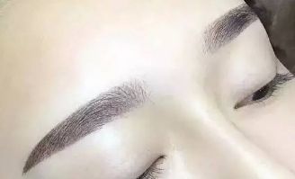 杜園園2023年雙眼皮修復(fù)案例揭秘，浦東區(qū)獨家經(jīng)驗分享