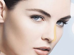 煙臺曹品根醫(yī)生的雙眼皮修復(fù)經(jīng)驗揭秘，90天修復(fù)案例全記錄