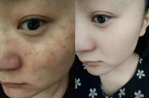 廣州微整形醫(yī)院專(zhuān)業(yè)排行，實(shí)力強(qiáng)勁，競(jìng)技大比拼！尋找您理想之選