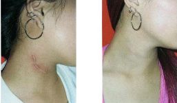 全國各大醫(yī)院推薦！拉皮手術(shù)高水平醫(yī)院盤點