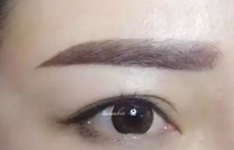 南昌美伊爾醫(yī)院的劉立軍醫(yī)生手術(shù)實力如何？擅長哪些手術(shù)？附真實案例為參考