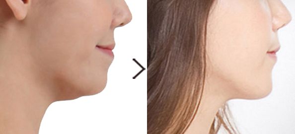 整形美容院選擇指南：華美、珍潤、藍山等品牌綜合比較，價格一覽表！