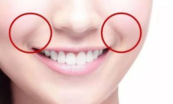 北京八大處整容院滕利醫(yī)生擅長哪些項目？磨骨案例被公開揭秘