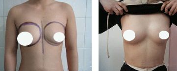 武漢優(yōu)秀鼻部專家排行榜公布，前五位備受矚目