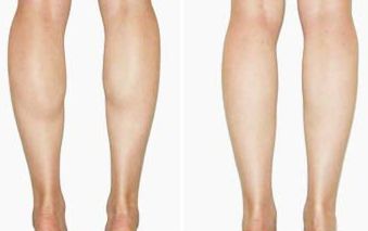 探尋南山整形醫(yī)院實(shí)力！醫(yī)生陣容揭秘+雙眼皮整形案例賞析