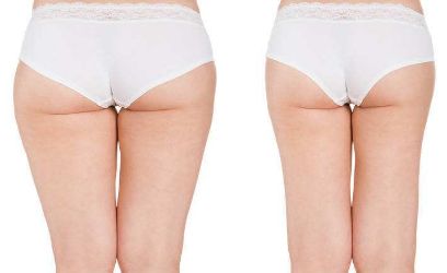 驚喜來襲！武漢葉子醫(yī)療美容醫(yī)院帶來全新鼻子塑造效果圖！